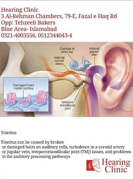 Hearing Aids I Hearing Tests I BERA, PTA, Tympanometry, Audiology. 9