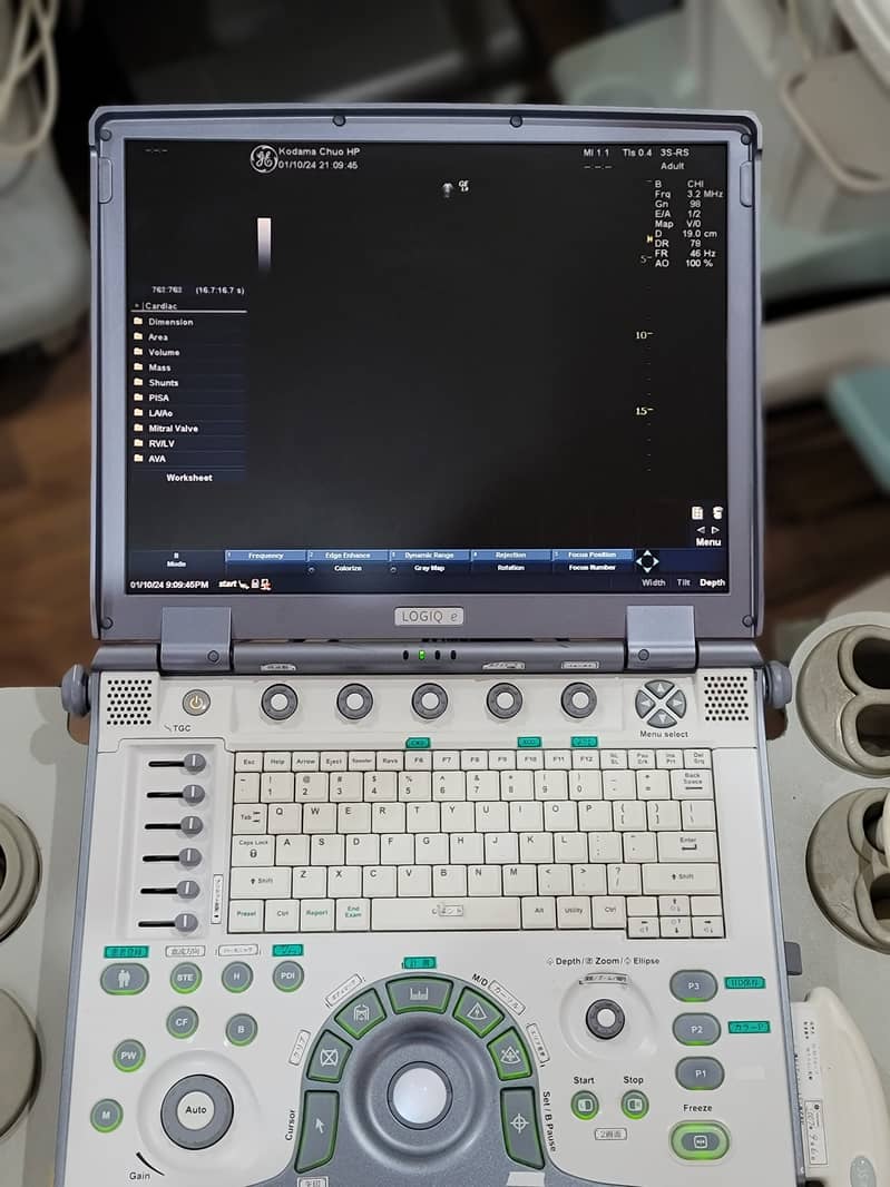 Ultrasound/LOGIQ e/ Ultrasound/machine 2