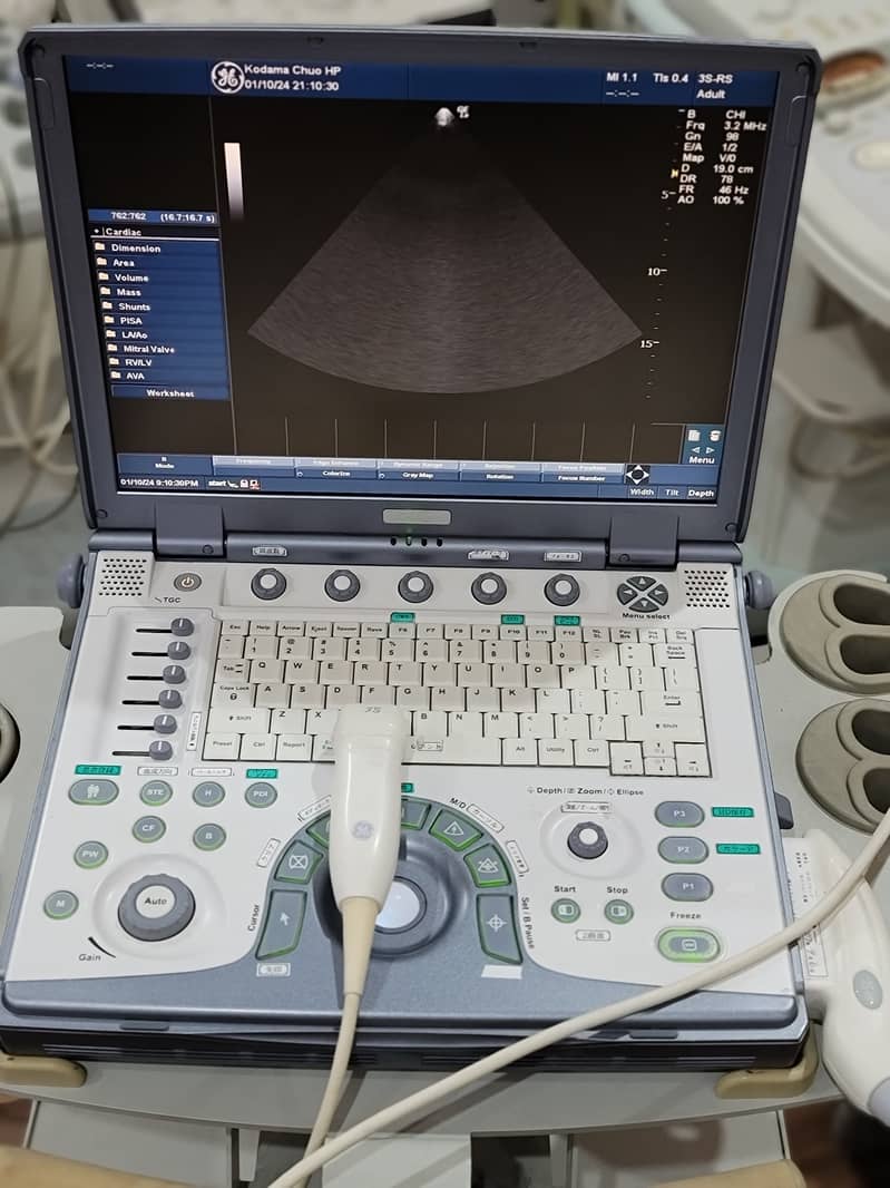 Ultrasound/LOGIQ e/ Ultrasound/machine 4