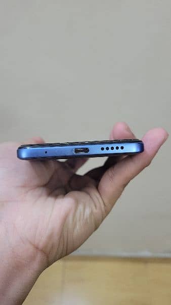 Xiaomi Redmi Note 11 3