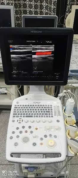 Ultrasound|ultrasound machines|03333338596 3