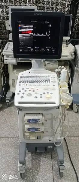 Ultrasound|ultrasound machines|03333338596 6
