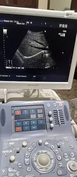 Ultrasound|ultrasound machines|03333338596 18