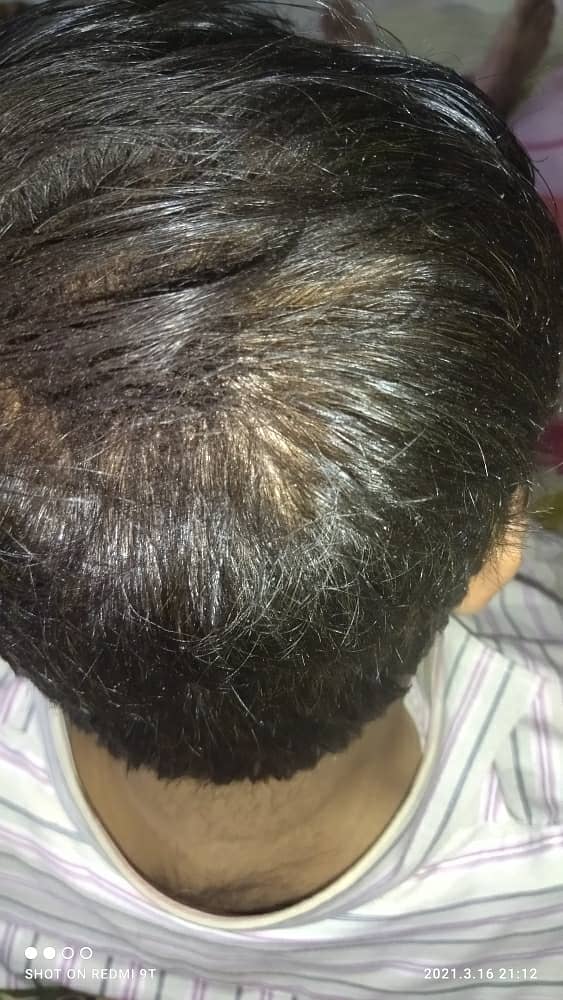 Caboki toppik Hair Fibers DARK Brown and black  25gm 03017186072 5