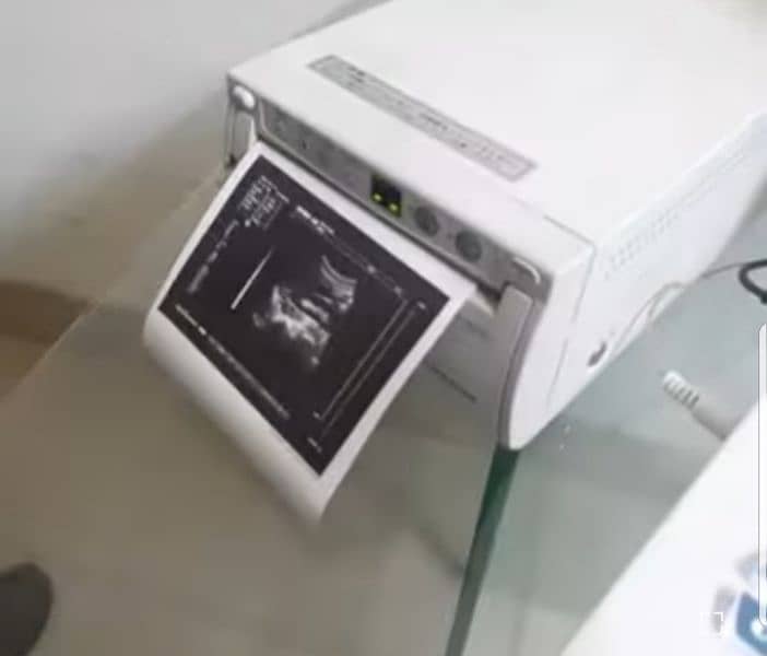 ultrasound machine high resolution portable and printer 2