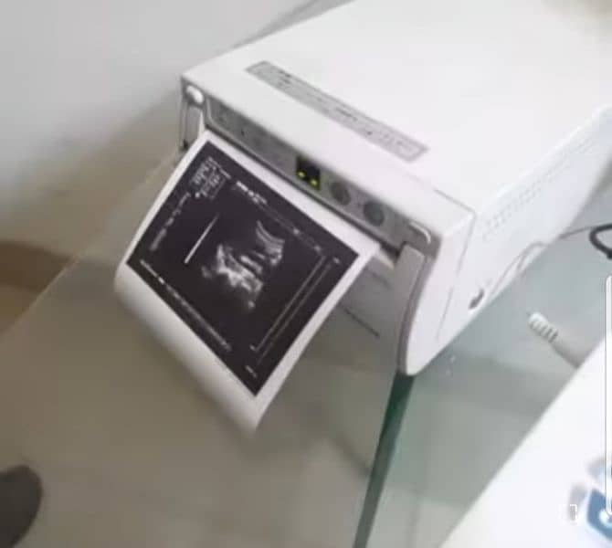 ultrasound machine high resolution portable and printer 4