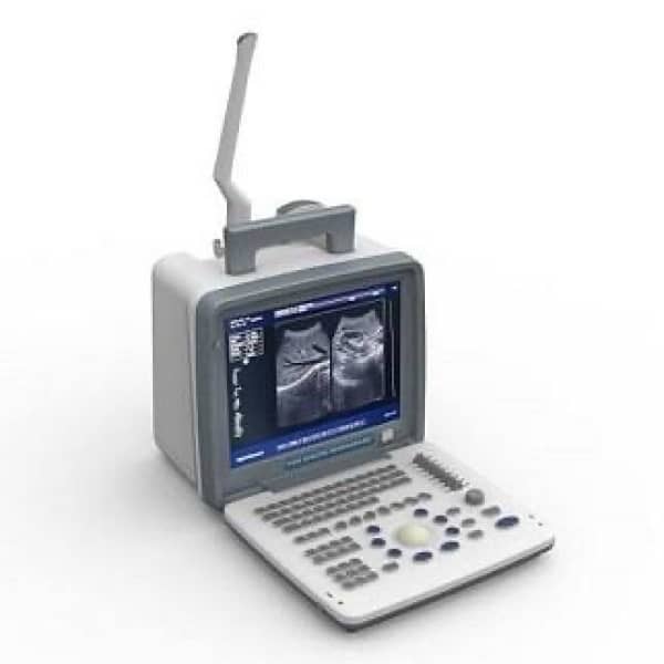 New Ultrasound Machine - Apolo 7 - Nyro 10 - 1 year warranty - karachi 6