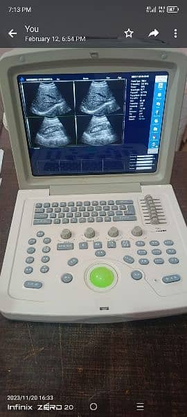 All types of ultrasound machine available in low prices 6