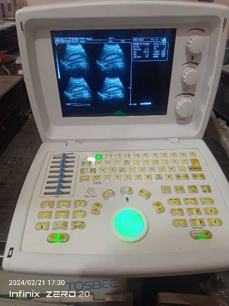 ultrasound machines 4