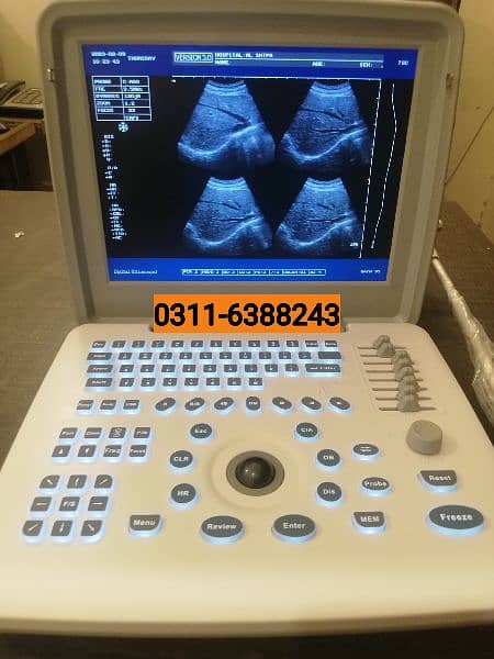 ultrasound machines 10