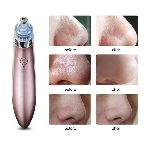 New) Wireless Blackheads Pore Vacuum Cleaner Device 2