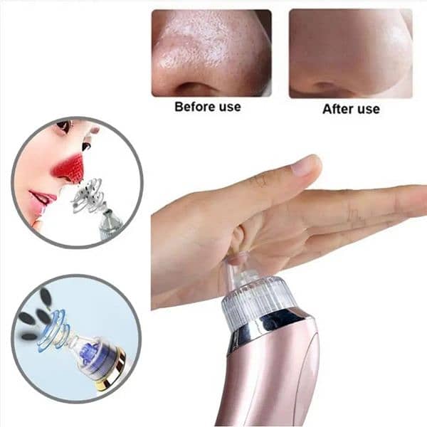 New) Wireless Blackheads Pore Vacuum Cleaner Device 4