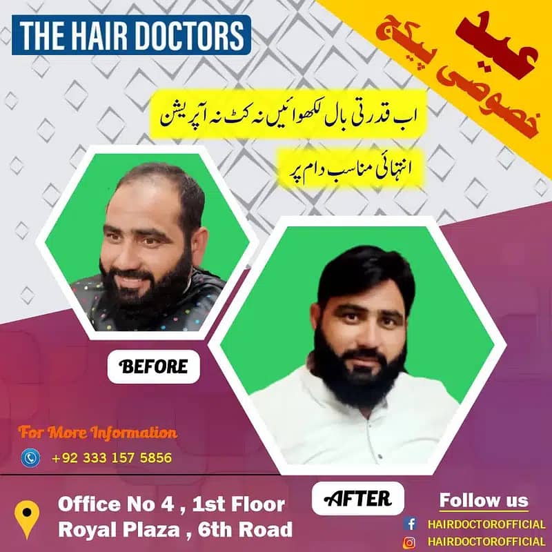 THE HAIR DOCTORS ( Hair patches ,wigs, services ) 3