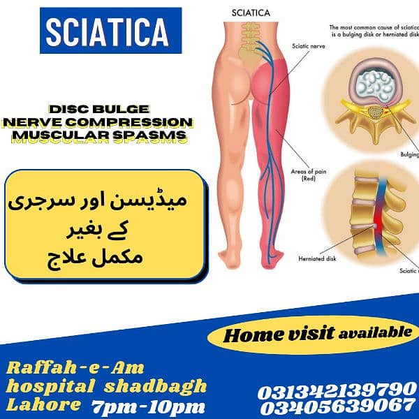 physiotherapy / Home services / visits / Hijama/cupping therapy/Lahore 1