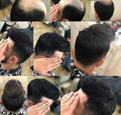 Men wig imported quality hair patch _hair unit_(0'3'0'6'4'2'3'9'1'0'1)