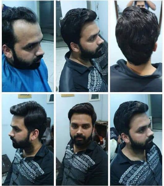 Men wig imported quality _hair patch _hair unit(0'3'0'6'4'2'3'9'1'0'1) 9