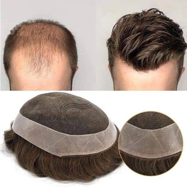 Men wig imported quality _hair patch _hair unit 0'3'0'6'4'2'3'9'1'0'1) 5