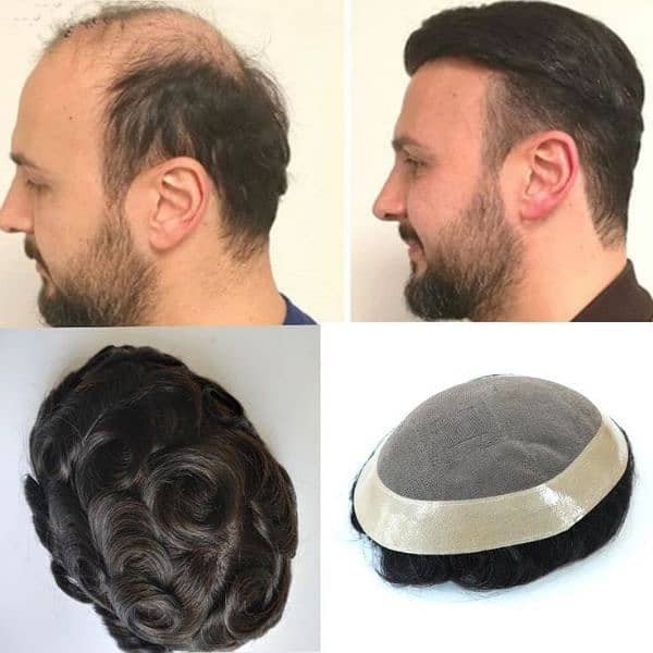 Men wig imported quality _hair patch _hair unit(0'3'0'6'4'2'3'9'1'0'1) 6