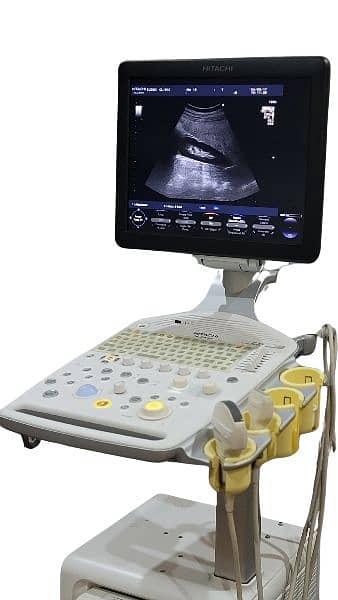 Ultrasound Machine Hitachi Aloka F37 1