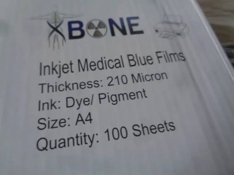 XBone Inkjet Medical X-ray films and Canon Epson Printer 1