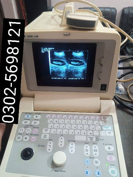 portable ultrasound machine available in stock 2