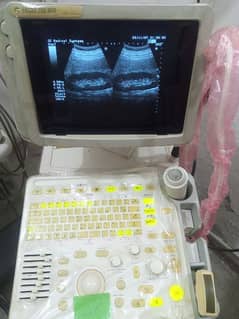 Refurbished ultrasound machine available in stock