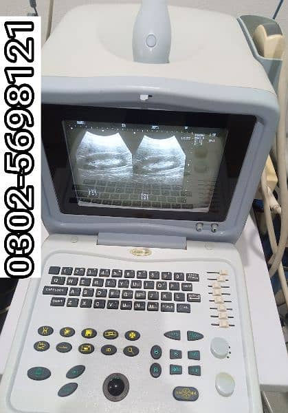portable ultrasound machine available in stock 6