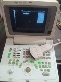 China ultrasound machine available in stock