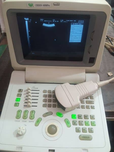 China ultrasound machine available in stock 0