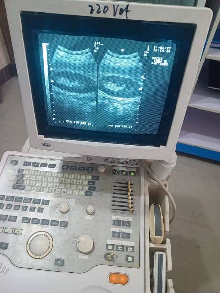 China ultrasound machine available in stock 6