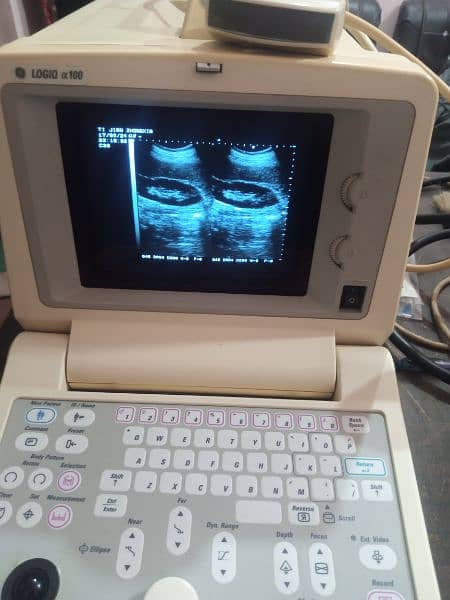 China ultrasound machine available in stock 7