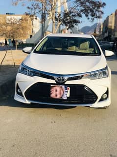 Toyota Corolla Altis for sale