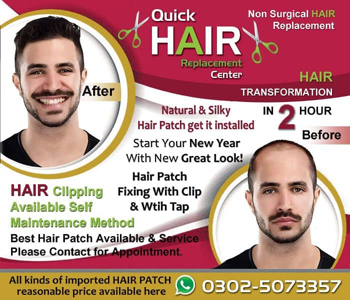 Hair wigs hair unit hair patch sale in Karachi. 0