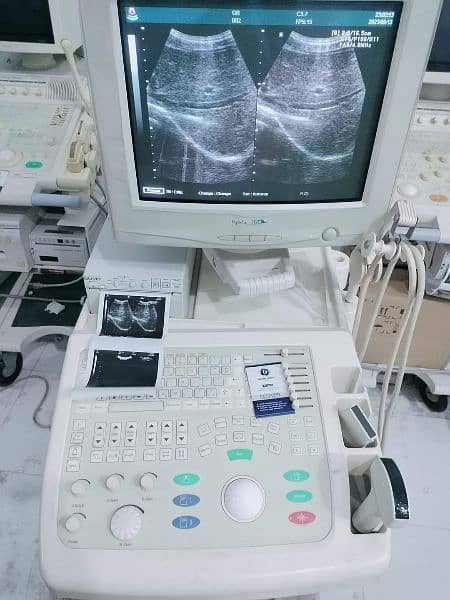 Ultrasound Machine japani available in ready stock 2