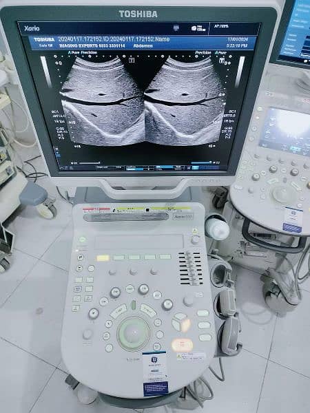 Toshiba Ultrasound Machine japani Xario 100 available in ready stock 2