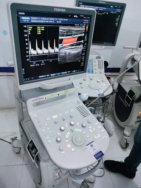 Toshiba Ultrasound Machine japani Xario 100 available in ready stock 4