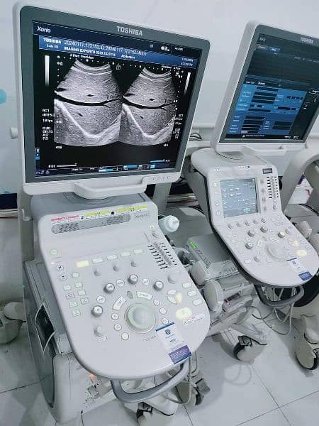 Toshiba Ultrasound Machine japani Xario 100 available in ready stock 5