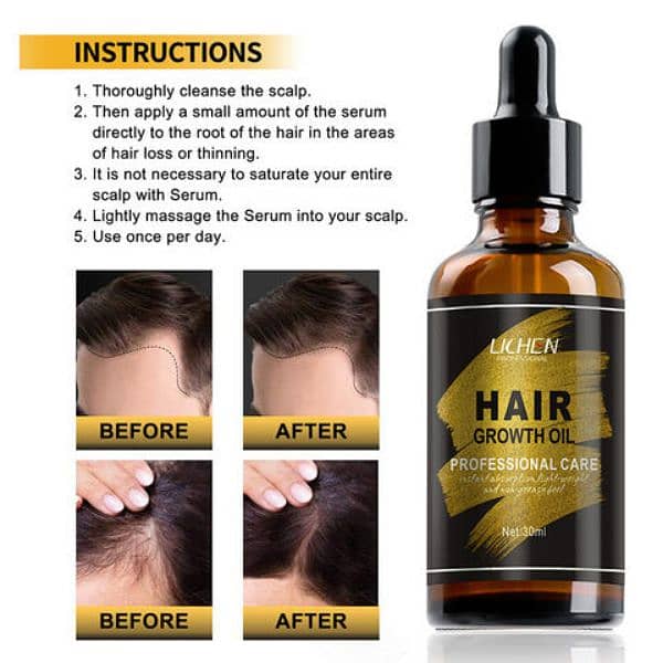 Fast Growing Hair Essential Oil Hair Growth 1