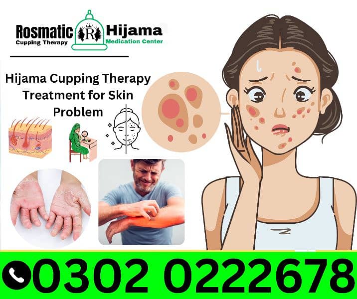Rosmatic Hijama Cupping Therapy Medication Center DHA  Clinic Hospital 6