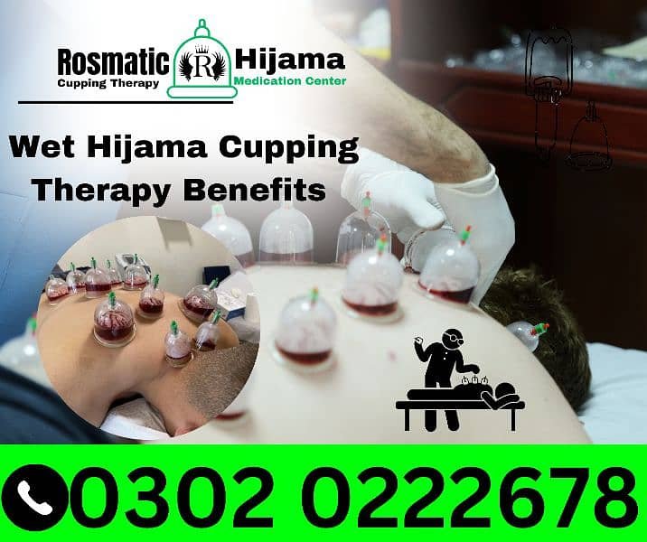 Rosmatic Hijama Cupping Therapy Medication Center DHA  Clinic Hospital 10