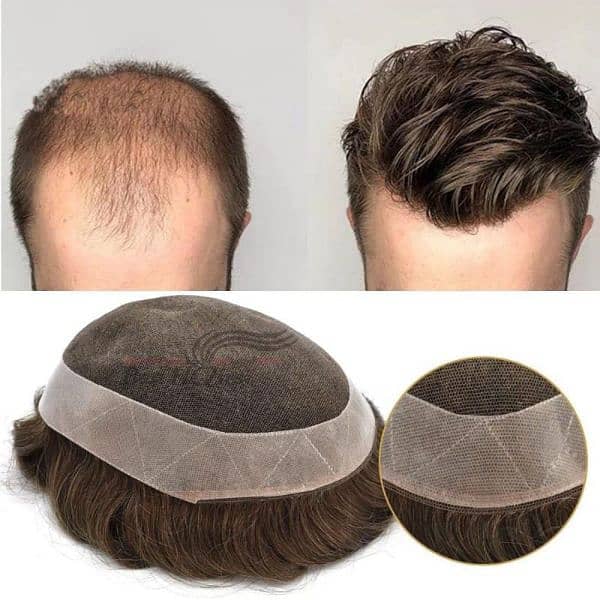 Men wig imported quality_hair patch _hair unit_(0'3'0'6'4'2'3'9'1'0'1) 1