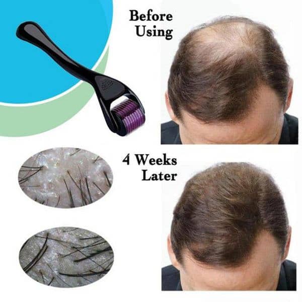 Derma Roller For Hair Growth - 0.5mm [Free Delivery] 2