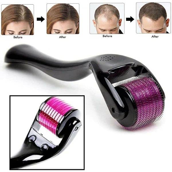 Derma Roller For Hair Growth - 0.5mm [Free Delivery] 3