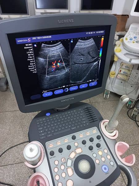 ultrasound machine O3325OO8691 1
