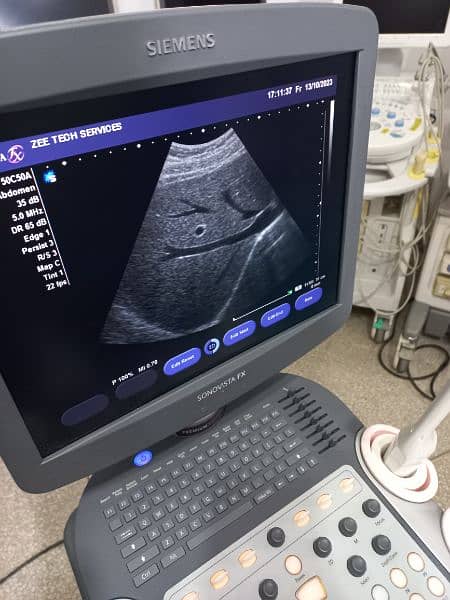 ultrasound machine O3325OO8691 2