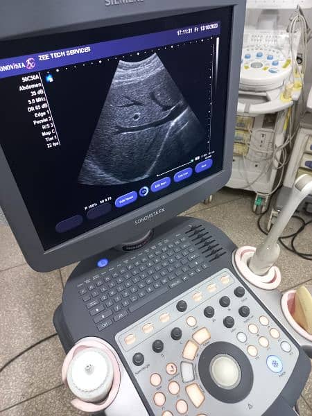 ultrasound machine O3325OO8691 3