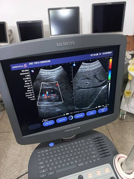 ultrasound machine O3325OO8691 9