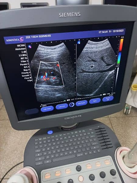 ultrasound machine O3325OO8691 10