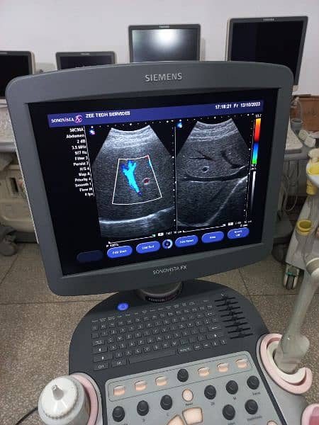ultrasound machine O3325OO8691 12