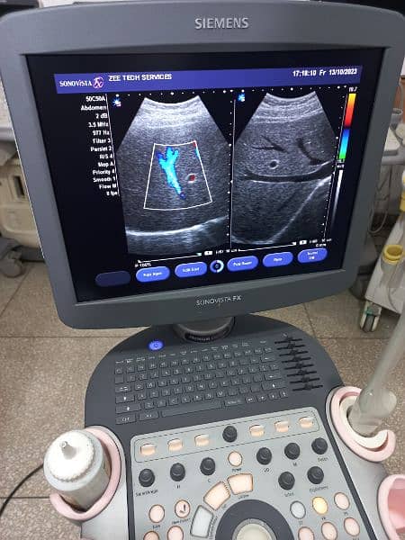 ultrasound machine O3325OO8691 14